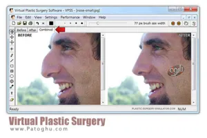 دانلود نرم افزار فوق العاده جراحی زیبایی - Virtual Plastic Surgery 1.2