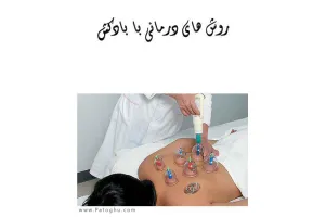 دانلود کتاب روش های درمانی با بادکش