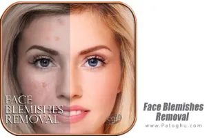 دانلود Face Blemishes Removal v1.6 – نرم افزار حذف لکه های صورت و روتوش برای اندروید