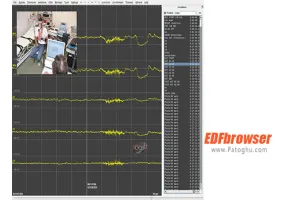 دانلود EDFbrowser 1.82 نمایش نموداری اطلاعات زمانی برای ویندوز